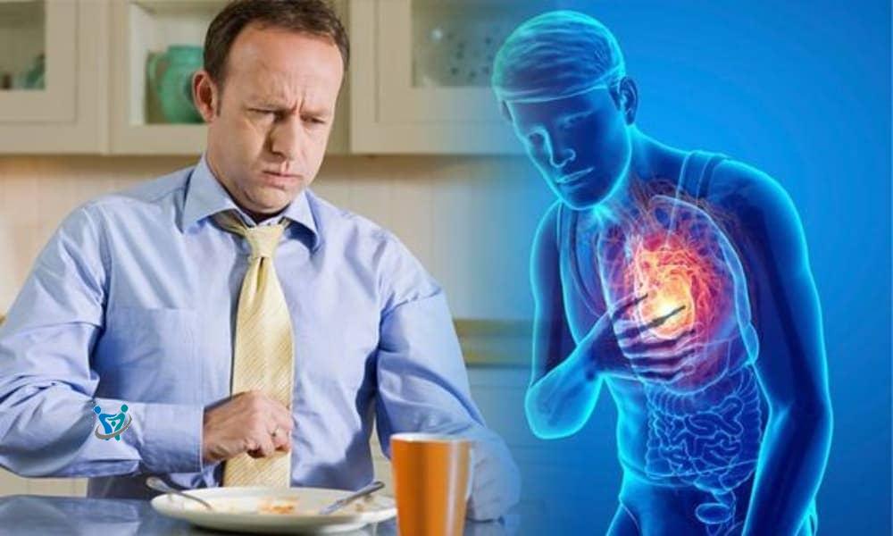 كيفية علاج الحموضة عند الرجال 1 كيفية علاج الحموضة عند الرجال